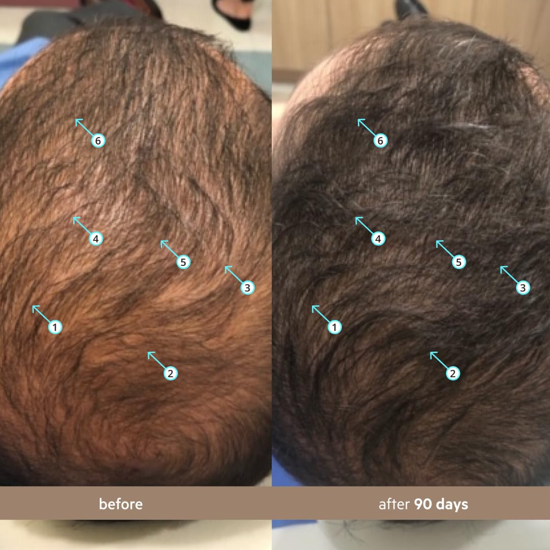 Men's Hair Revitalizing Density Serum™