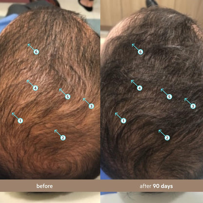 Men's Hair Revitalizing Density Serum™