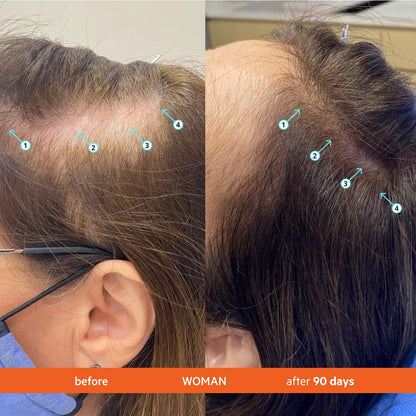 Revita™ Hair Thickening Shampoo TM