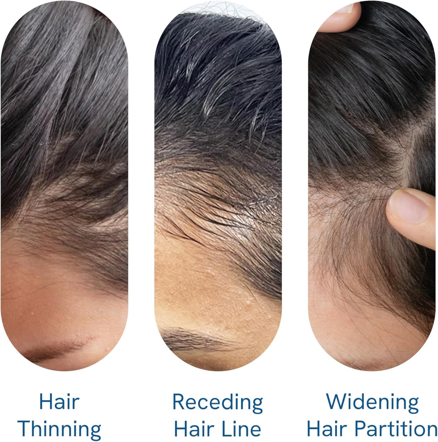 Luscious Locks Revitalizing Serum™